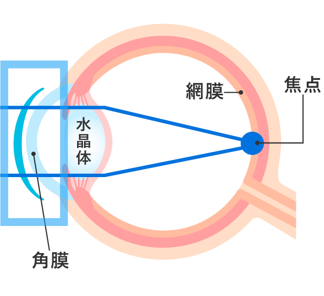 昼:レンズをはずした後